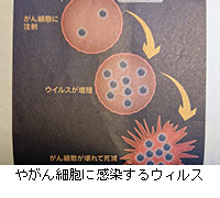 写真：やがん細胞に感染するウィルス